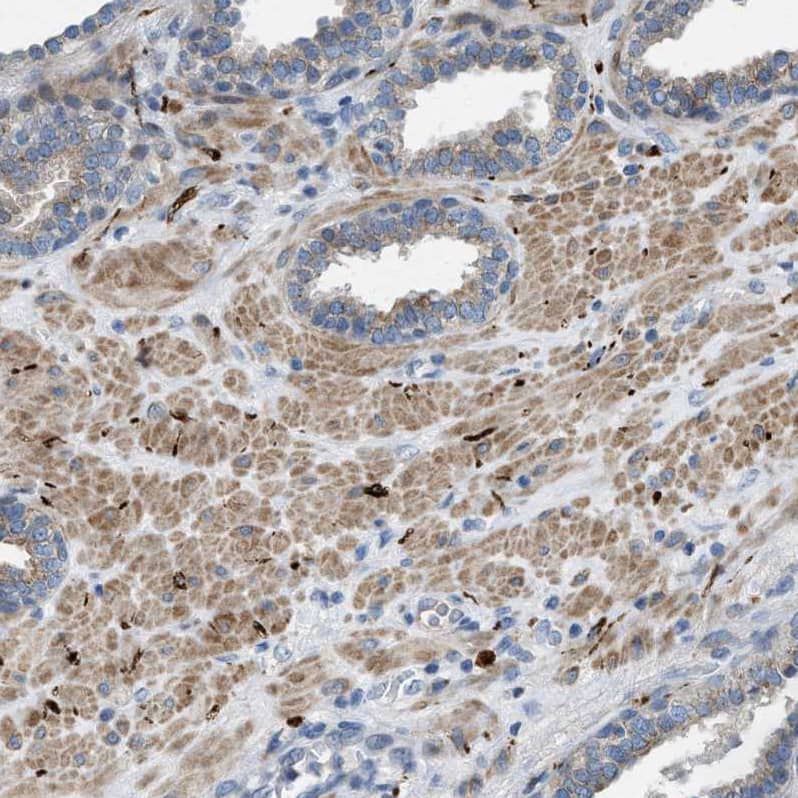 Staining of human prostate shows moderate cytoplasmic positivity in smooth muscle cells.
