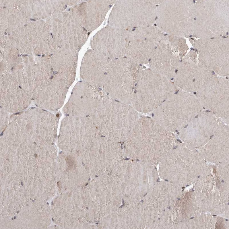 Immunohistochemistry-Paraffin MYD118 Antibody - BSA Free