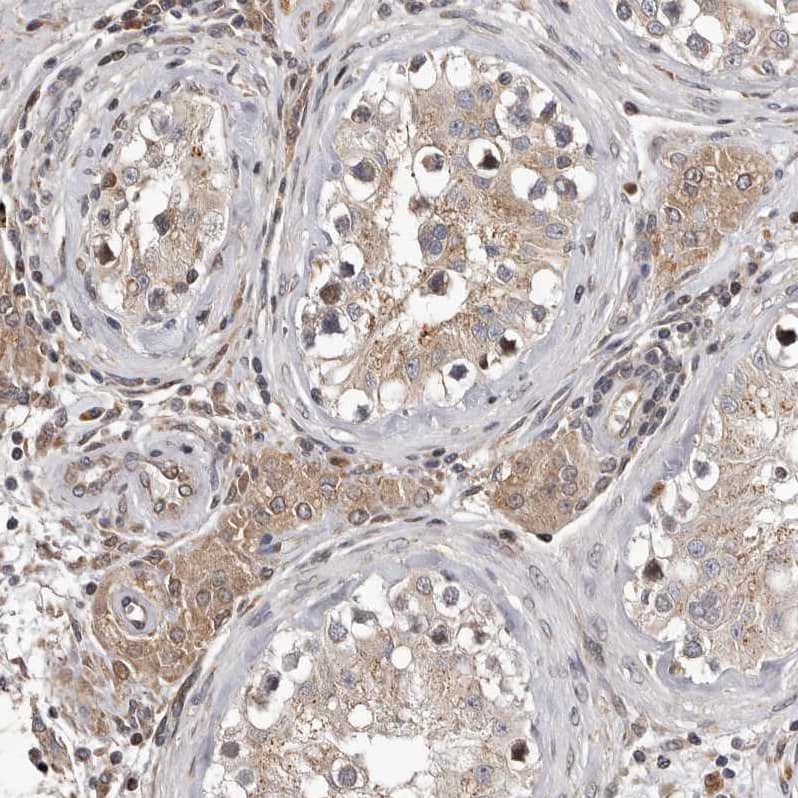 Immunohistochemistry-Paraffin MYD118 Antibody - BSA Free