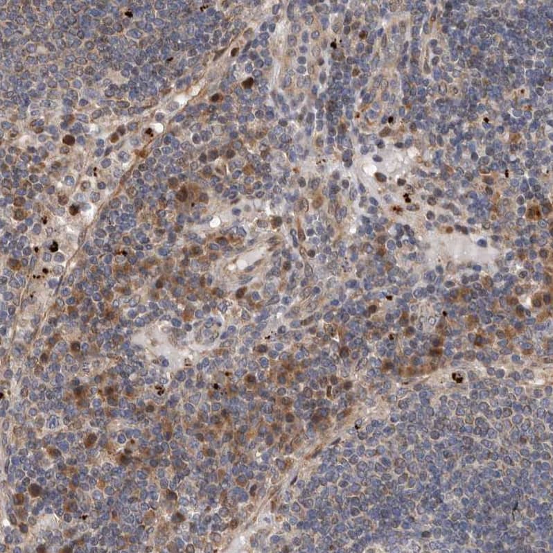 Immunohistochemistry-Paraffin MYD118 Antibody - BSA Free