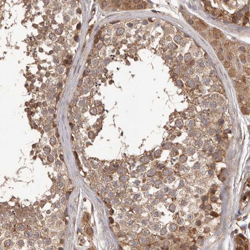 Immunohistochemistry-Paraffin QRSL Antibody - BSA Free