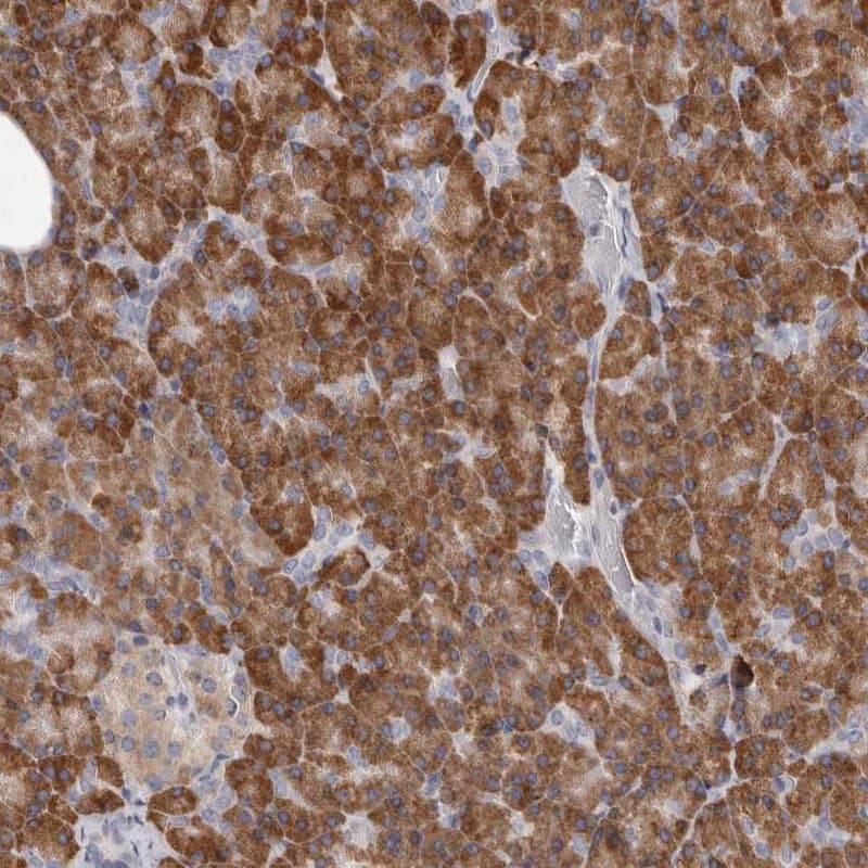 Staining of human pancreas shows strong cytoplasmic positivity in exocrine cells.