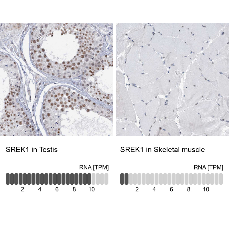 Immunohistochemistry-Paraffin SFRS12 Antibody - BSA Free