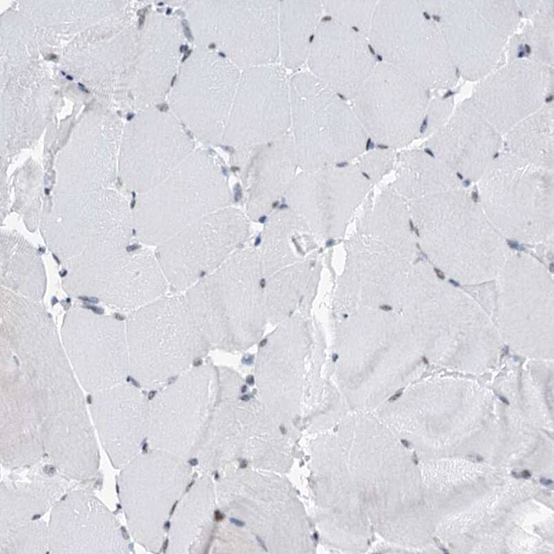 Immunohistochemistry-Paraffin SFRS12 Antibody - BSA Free