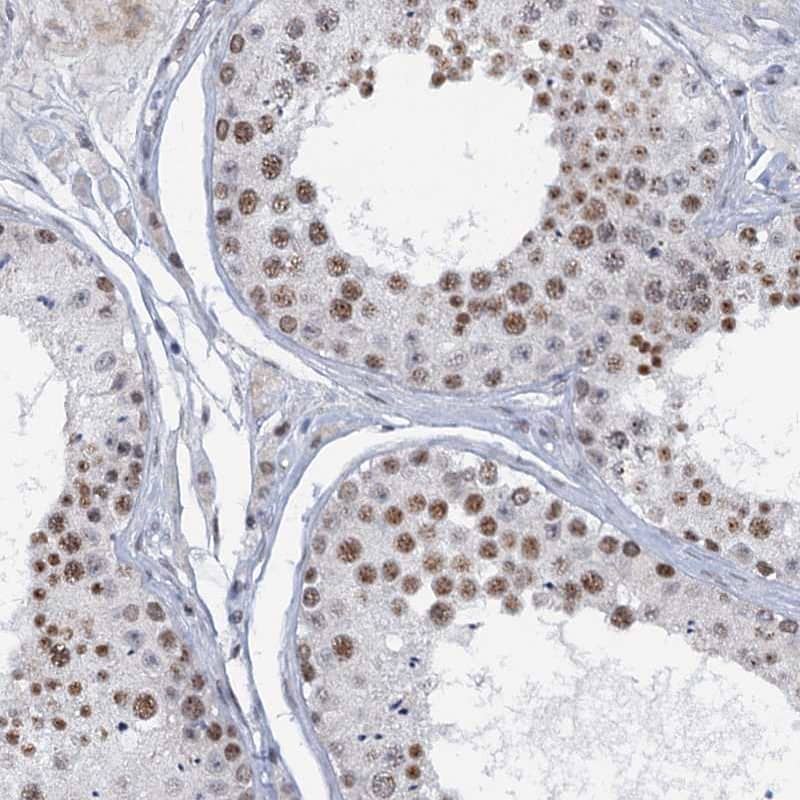 Staining of human testis shows high expression.