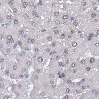 Staining of human liver.