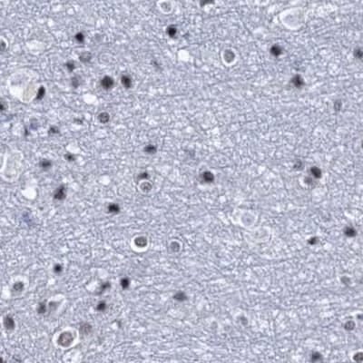 Staining of human cerebral cortex.