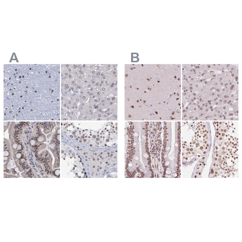 Staining of human cerebral cortex, liver, small intestine and testis HPA037674 (A) shows similar protein distribution across tissues to independent antibody HPA059332 (B).