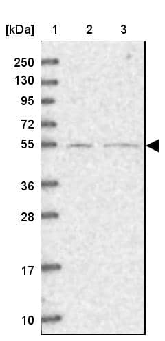 Lane 1: Marker [kDa] 250, 130, 95, 72, 55, 36, 28, 17, 10Lane 2: Human cell line RT-4Lane 3: Human cell line U-251MG sp