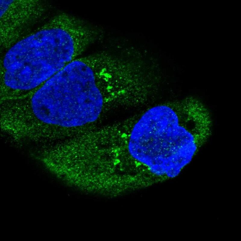 Staining of human cell line A-431 shows localization to cytosol & the Golgi apparatus.