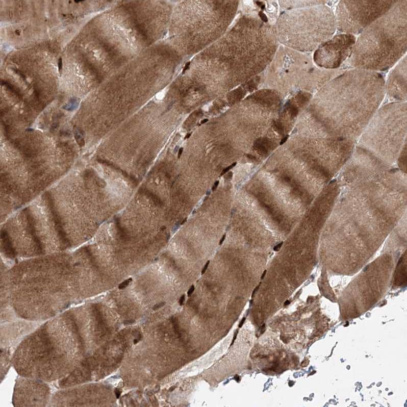 Immunohistochemistry-Paraffin ZNF650 Antibody - BSA Free