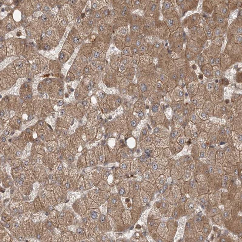 Staining of human liver shows moderate membranous and cytoplasmic positivity in hepatocytes.