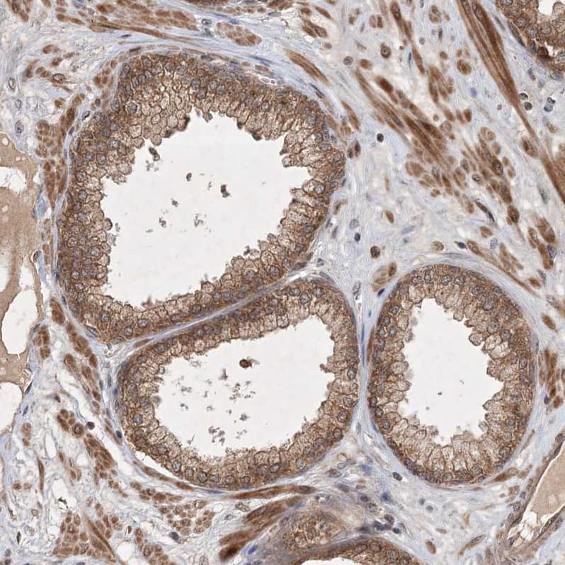 Staining of human prostate shows moderate membranous and cytoplasmic positivity in glandular cells.