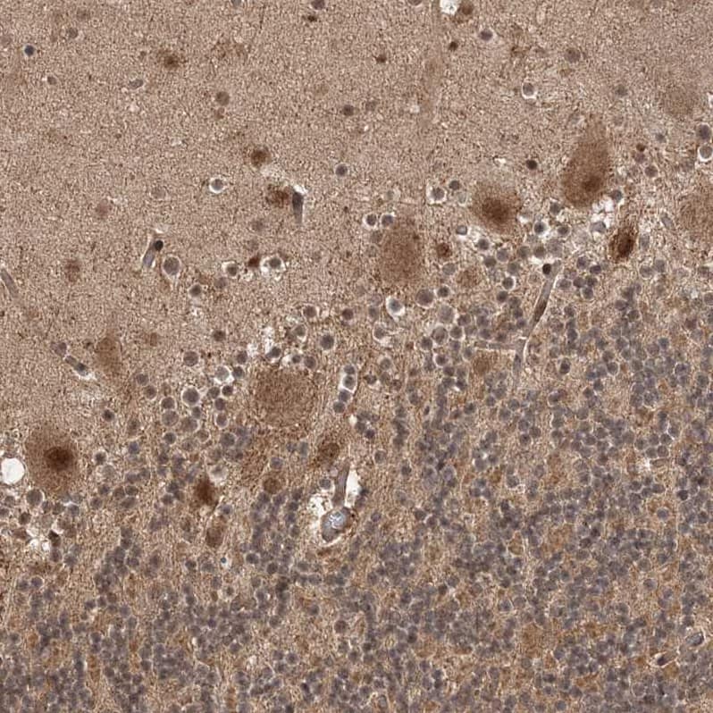 Staining of human cerebellum shows strong cytoplasmic, membranous and nuclear positivity in Purkinje cells.