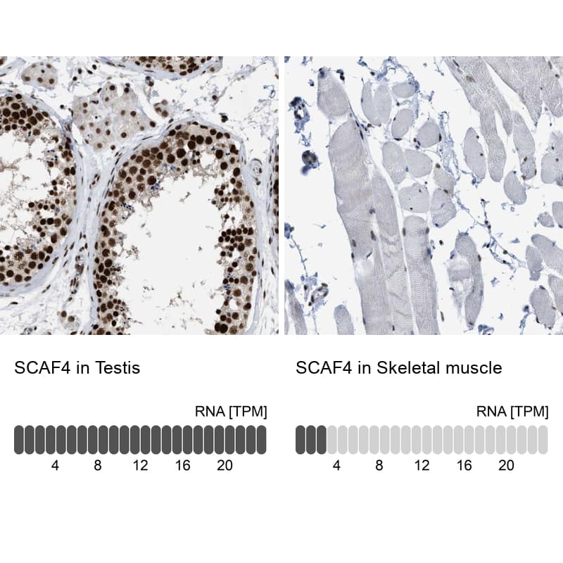 Analysis in human testis and skeletal muscle tissues.