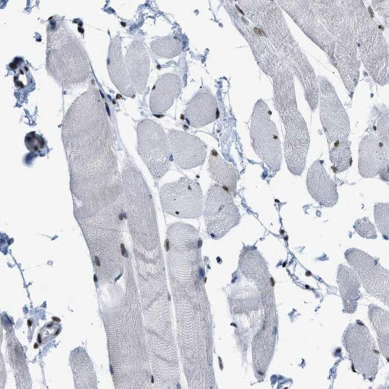 Staining of human skeletal muscle shows low expression as expected.