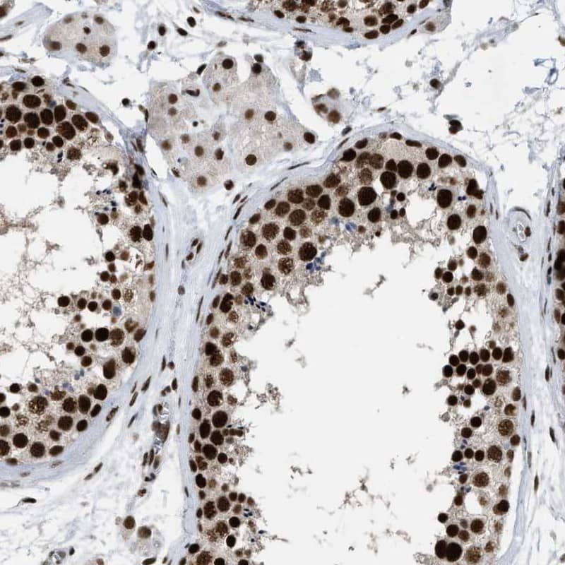 Staining of human testis shows high expression.