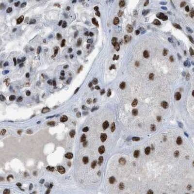 Staining of human kidney.