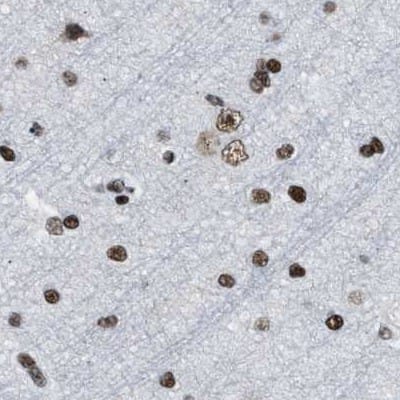 Staining of human cerebral cortex.