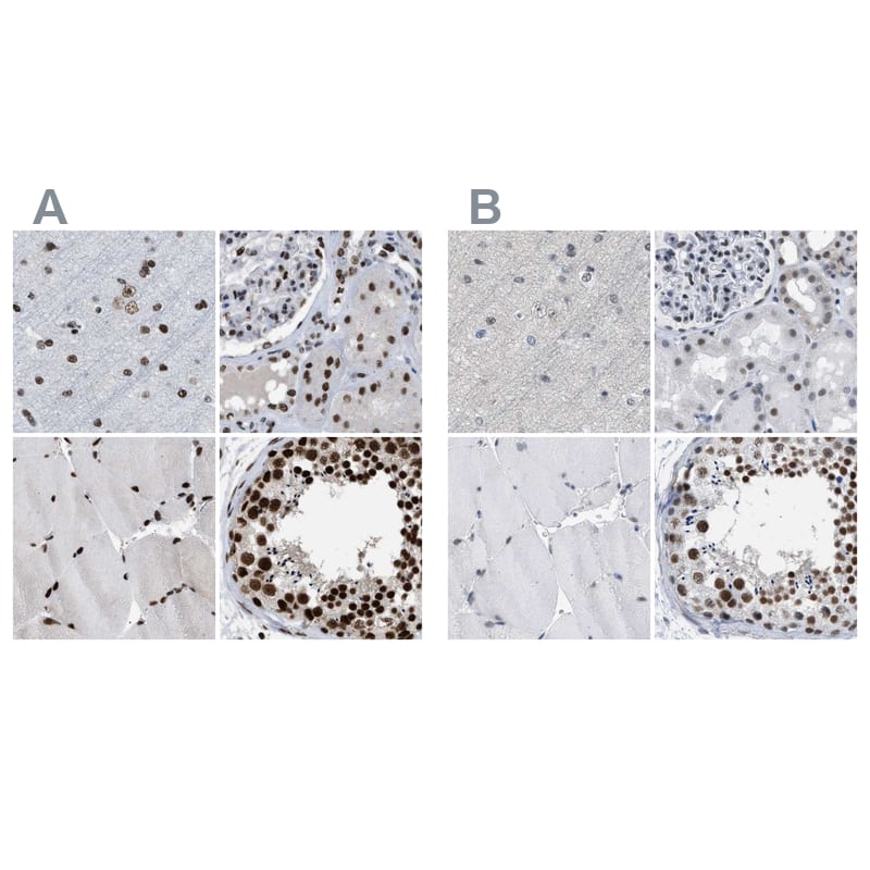 Staining of human cerebral cortex, kidney, skeletal muscle and testis HPA018319 (A) shows similar protein distribution across tissues to independent antibody HPA018668 (B).