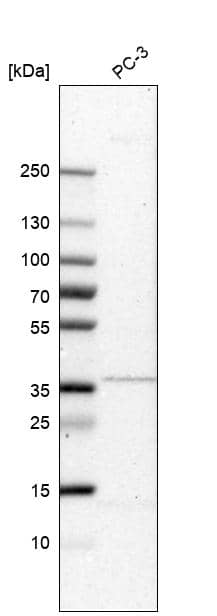 Analysis in human cell line PC-3.