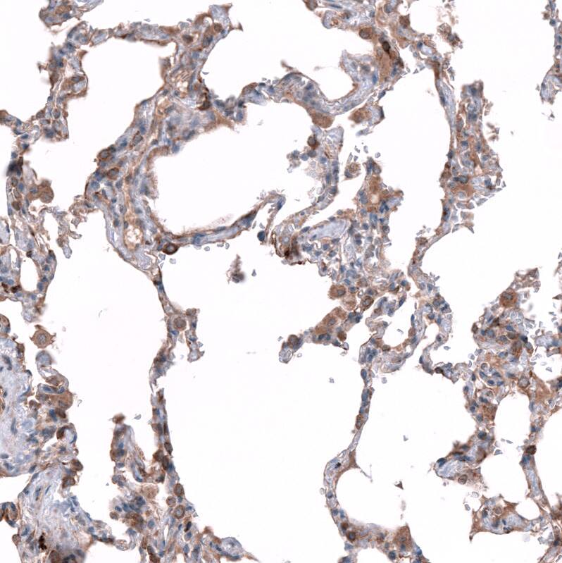 Staining of human lung shows moderate cytoplasmic positivity in macrophages and alveolar cells.