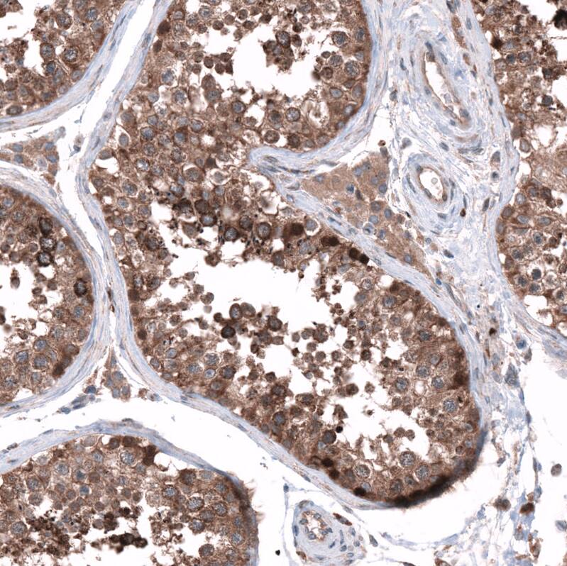Staining of human testis shows strong cytoplasmic positivity in cells in tubules.