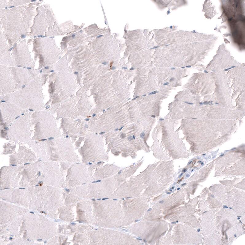 Staining of human skeletal muscle shows no positivity in myocytes as expected.