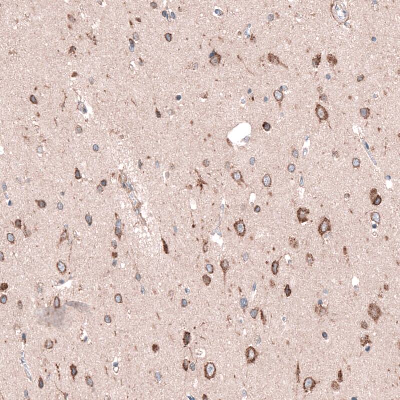 Staining of human cerebral cortex shows strong cytoplasmic positivity in glial cells and neurons.