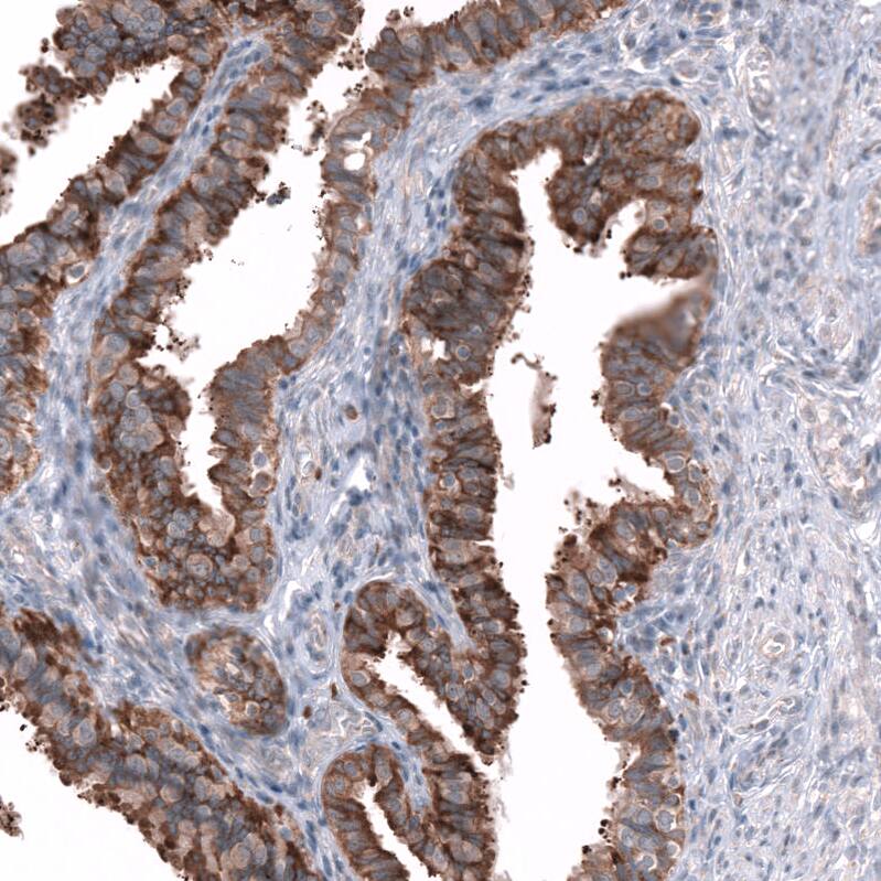 Staining of human fallopian tube shows strong cytoplasmic positivity in glandular cells.
