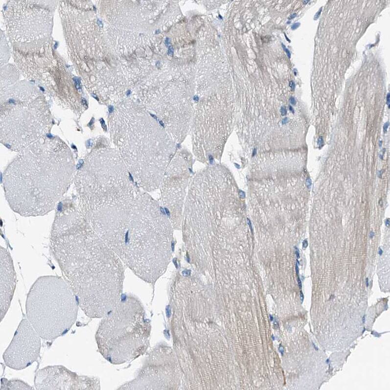 Immunohistochemistry-Paraffin WDR51A Antibody - BSA Free