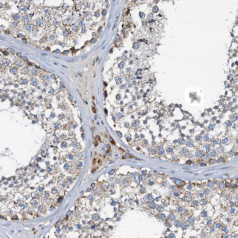 Immunohistochemistry-Paraffin WDR51A Antibody - BSA Free