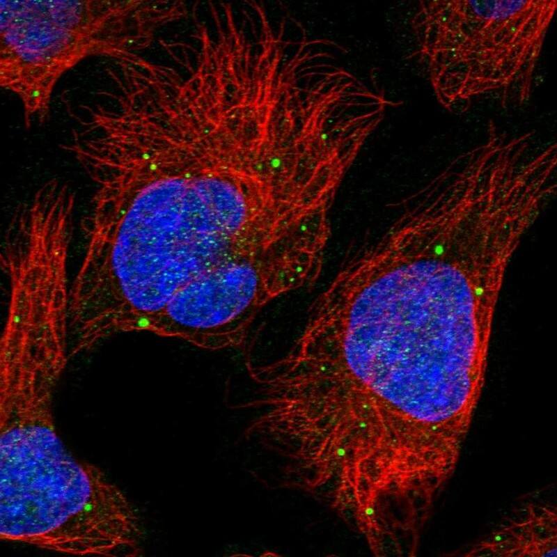 Staining of human cell line U-2 OS shows localization to vesicles.