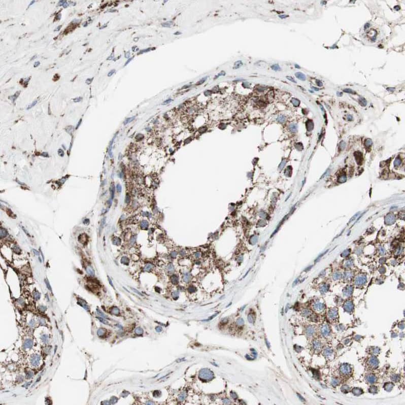 Immunohistochemistry-Paraffin Proprotein convertase PC4 Antibody - BSA Free