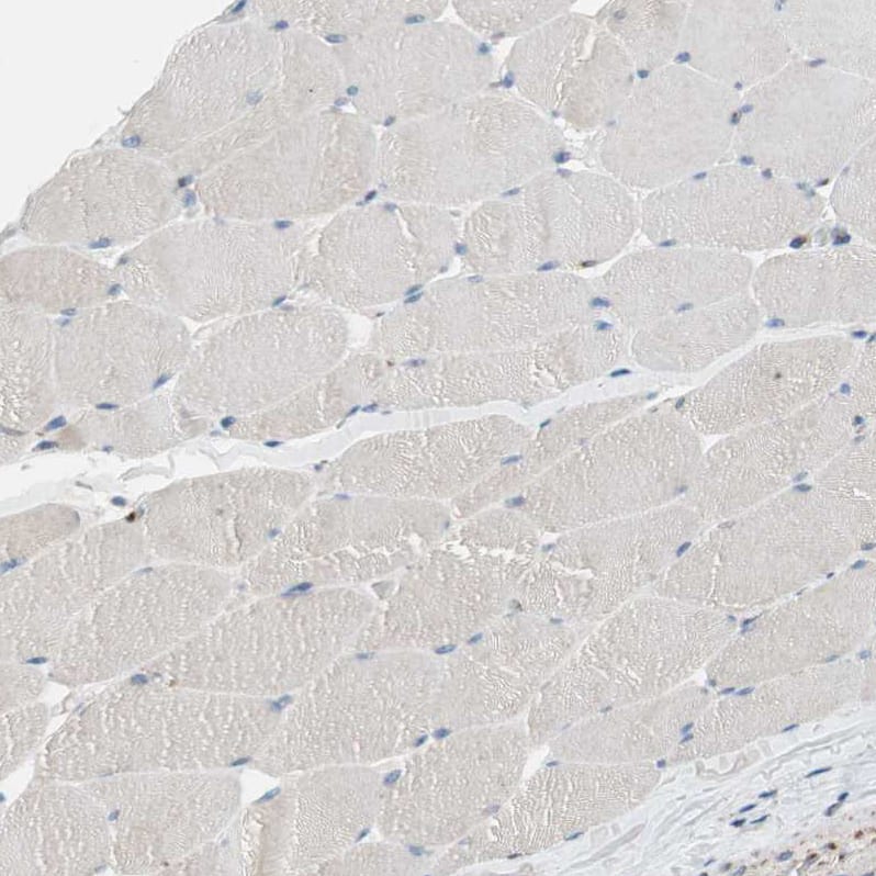 Immunohistochemistry-Paraffin Proprotein convertase PC4 Antibody - BSA Free