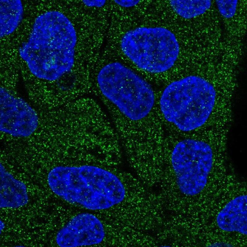 Staining of human cell line RT4 shows localization to cytosol.