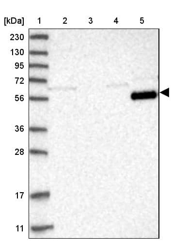 Lane 1: Marker [kDa] 230, 130, 95, 72, 56, 36, 28, 17, 11Lane 2: Human cell line RT-4Lane 3: Human cell line U-251MG spLane 4: Human plasma (IgG/HSA depleted)Lane 5: Human liver tissue