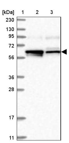 Lane 1: Marker [kDa] 230, 130, 95, 72, 56, 36, 28, 17, 11Lane 2: Human cell line RT-4Lane 3: Human cell line U-251MG sp