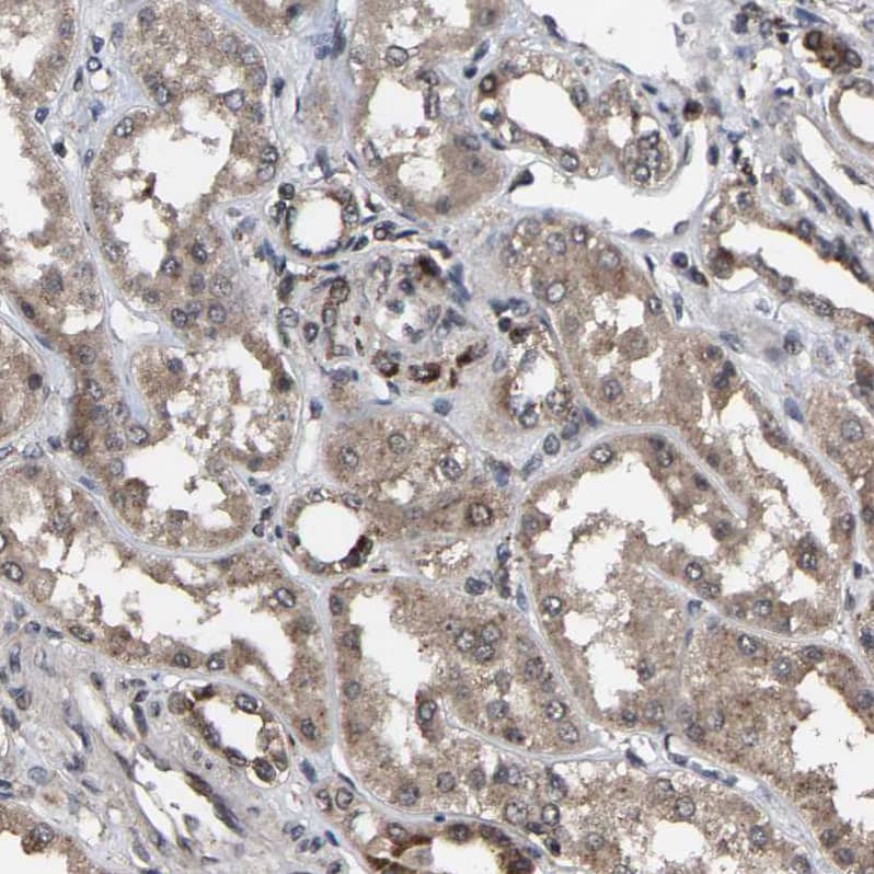 Staining of human kidney shows weak granular cytoplasmic positivity in cells in tubules.