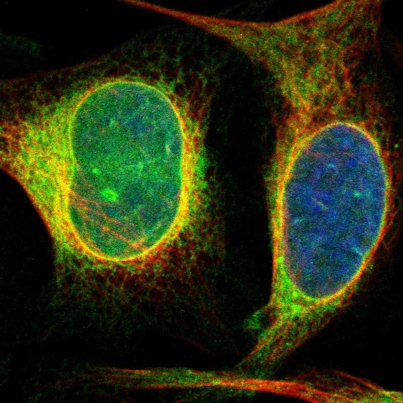 Immunocytochemistry/ Immunofluorescence Derlin 1 Antibody - BSA Free