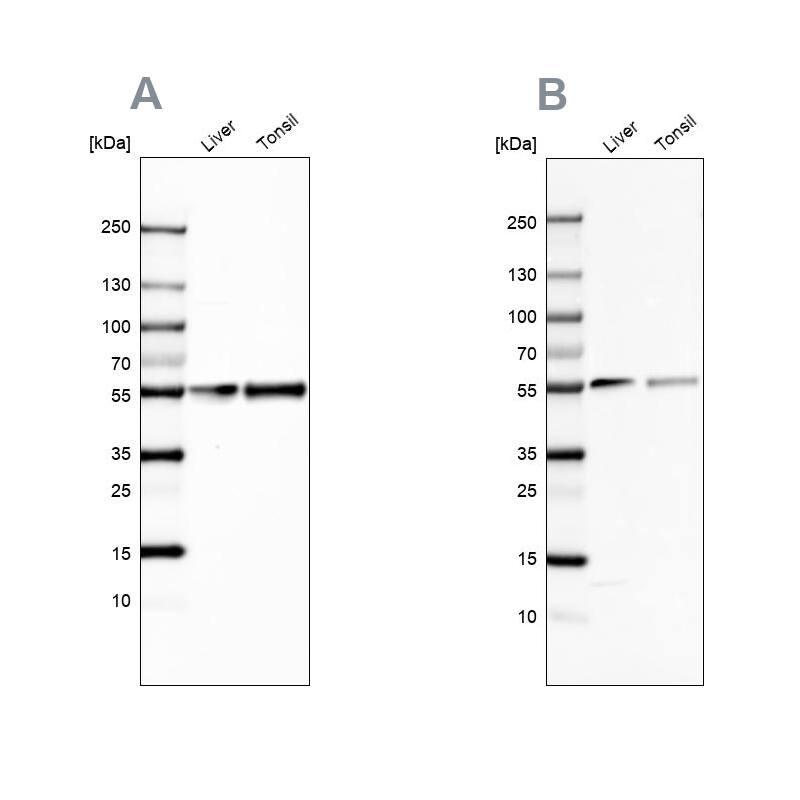 Western Blot Vitamin D BP Antibody - BSA Free