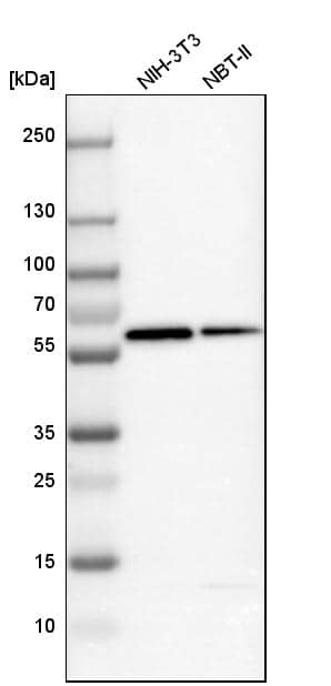 Western Blot Vitamin D BP Antibody - BSA Free