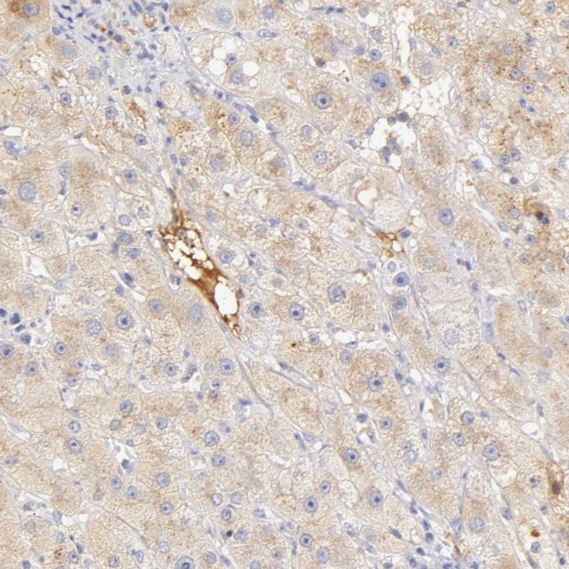 <b>Independent Antibodies Validation. </b>Staining of human liver shows cytoplasmic positivity in hepatocytes.