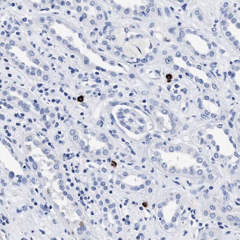 Staining of human kidney shows  strong cytoplasmic positivity in lymphocytes.