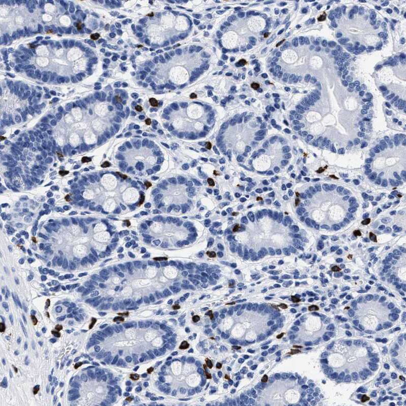Staining of human duodenum shows strong cytoplasmic positivity in lymphocytes.