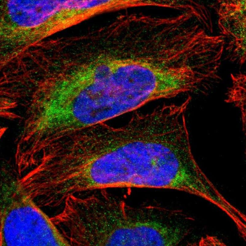 Staining of human cell line U-2 OS shows localization to endoplasmic reticulum.