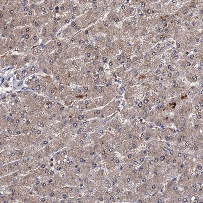 Immunohistochemistry-Paraffin CSTP1 Antibody - BSA Free