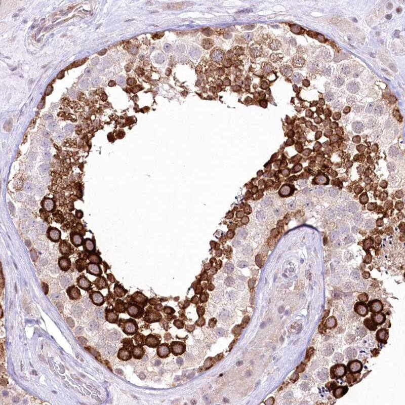 Staining of human testis shows strong cytoplasmic positivity in cells in seminiferus ducts.