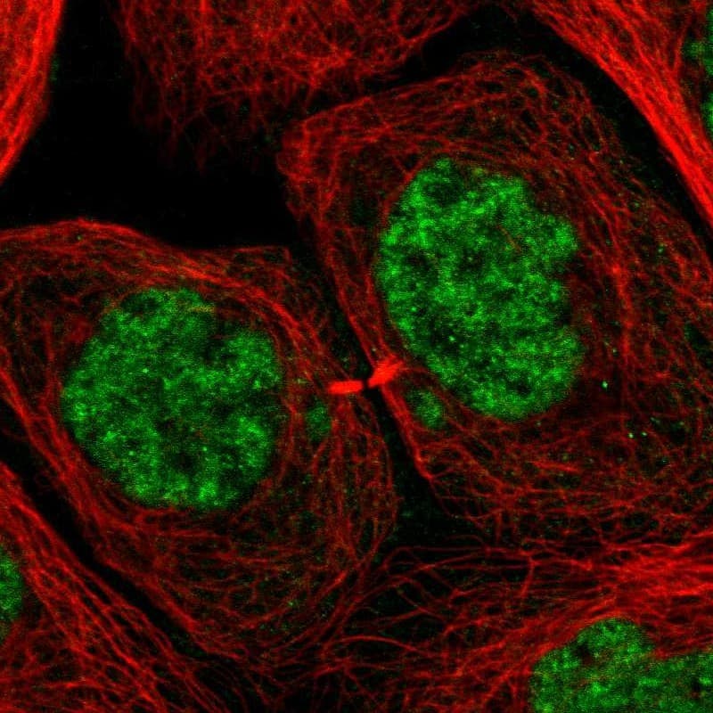 Staining of human cell line A-431 shows localization to nuclear speckles.