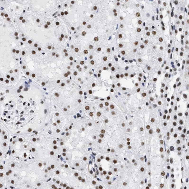 Staining of human kidney shows strong positivity in nuclear speckles in cells in tubules.
